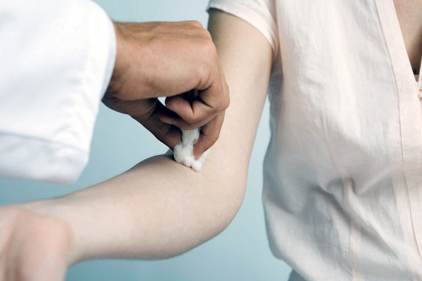 Tumori, test sul sangue per prevederli fino a 13 anni prima